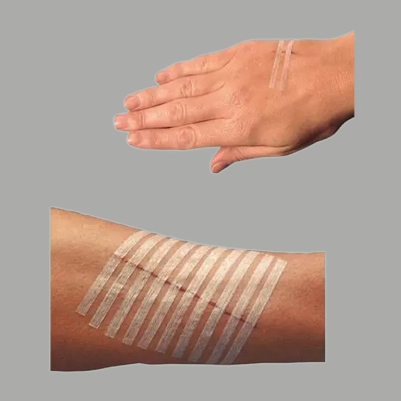 butterfly strips butterfly strips